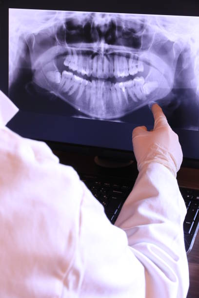 Best Emergency Denture Repair in Moxee, WA